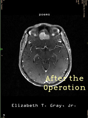 cover image of After the Operation